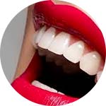 dentisterie esthetique